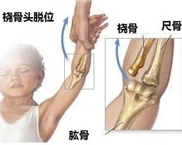 丁广江